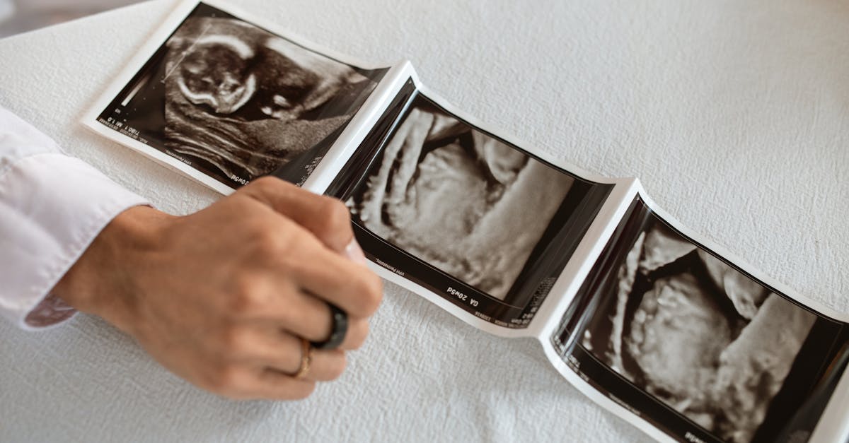 préparez-vous à l'accouchement avec notre guide complet sur la préparation à la naissance. découvrez des conseils pratiques, des informations sur les différentes méthodes d'accouchement et des techniques de relaxation pour vivre ce moment unique en toute sérénité.