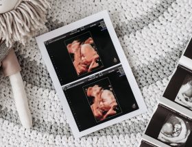 découvrez nos conseils et ressources pour vous préparer à l'accouchement. apprenez les techniques de respiration, les méthodes de relaxation et toutes les informations essentielles pour vivre cette expérience unique en toute sérénité.