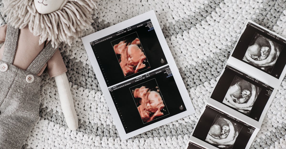 découvrez l'importance des soins prénatals pour assurer la santé de la mère et du bébé pendant la grossesse. informez-vous sur les visites médicales essentielles, les tests recommandés et les conseils pour une grossesse saine. prenez soin de vous et de votre futur enfant grâce à des informations précises et utiles.