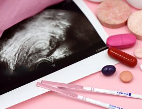 découvrez l'importance des vitamines prénatales pour la santé de la mère et du bébé. apprenez comment ces compléments peuvent soutenir une grossesse saine en fournissant les nutriments essentiels nécessaires au développement optimal de votre enfant.