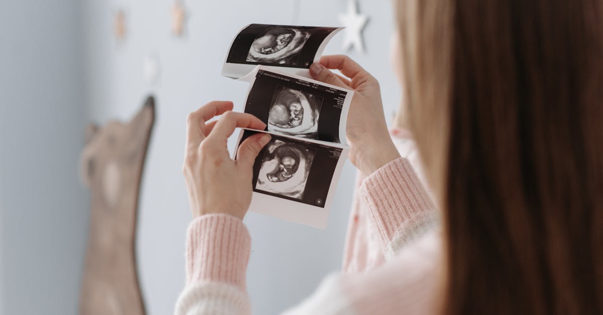 découvrez les avancées et applications de l'échographie, un outil médical essentiel pour le diagnostic et le suivi des patients. informez-vous sur son fonctionnement, ses avantages et son rôle dans la santé moderne.