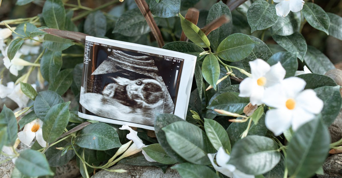 découvrez les bienfaits de l'accouchement physiologique, une méthode naturelle qui respecte le rythme du corps et favorise le lien entre la mère et l'enfant. apprenez comment cette approche holistique contribue à une expérience de naissance sereine et épanouissante.
