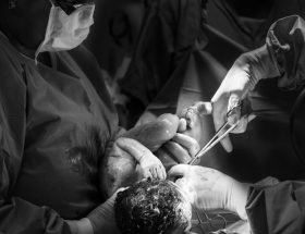 découvrez les bienfaits de l'accouchement physiologique, une approche naturelle qui favorise le lien entre la mère et l'enfant, tout en respectant les rythmes biologiques de la naissance. apprenez les techniques, conseils et pratiques pour vivre ce moment unique avec sérénité.