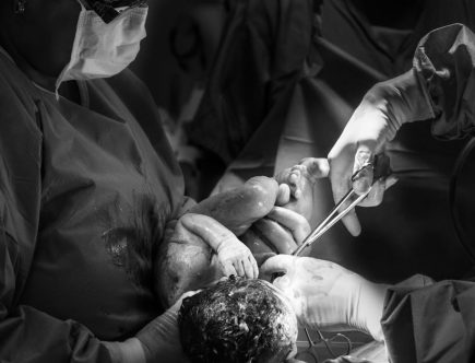 découvrez les bienfaits de l'accouchement physiologique, une approche naturelle qui favorise le lien entre la mère et l'enfant, tout en respectant les rythmes biologiques de la naissance. apprenez les techniques, conseils et pratiques pour vivre ce moment unique avec sérénité.