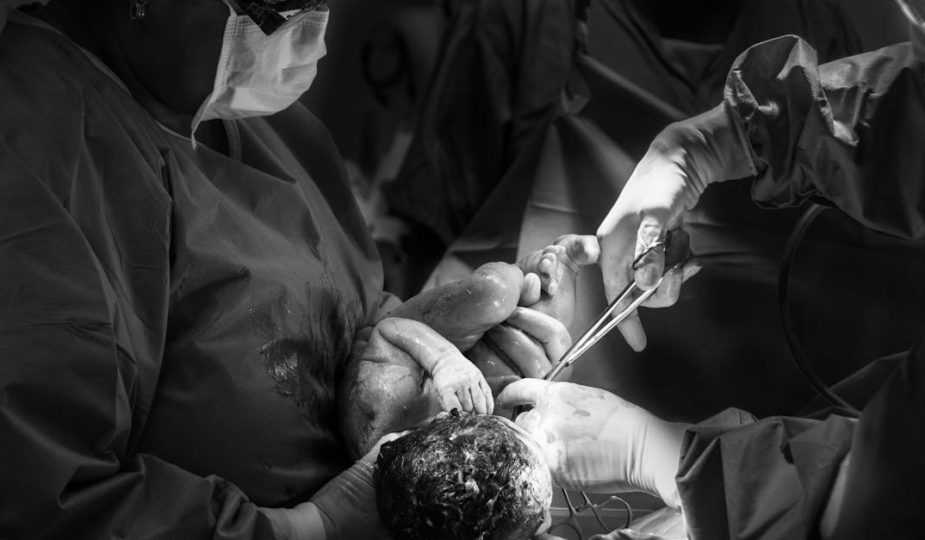 découvrez les bienfaits de l'accouchement physiologique, une approche naturelle qui favorise le lien entre la mère et l'enfant, tout en respectant les rythmes biologiques de la naissance. apprenez les techniques, conseils et pratiques pour vivre ce moment unique avec sérénité.