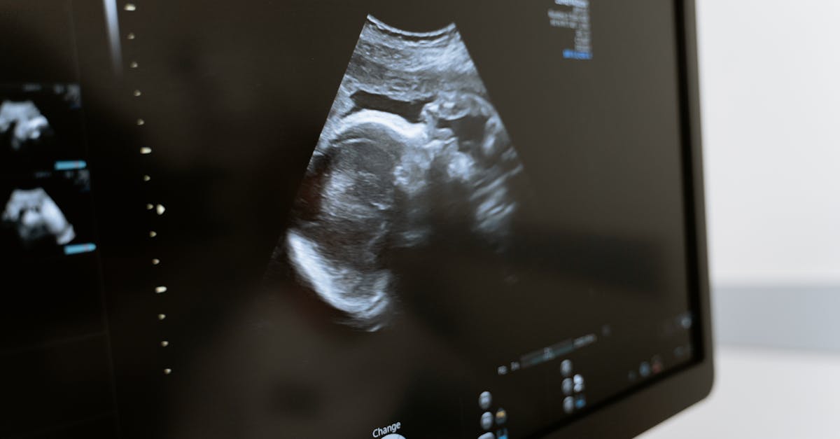 découvrez tout ce que vous devez savoir sur les douleurs de grossesse : causes, conseils pour les atténuer et quand consulter un professionnel. préparez-vous à vivre une expérience sereine et informée durant votre grossesse.
